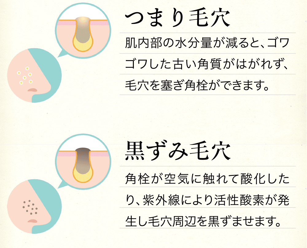 つまり毛穴、黒ずみ毛穴