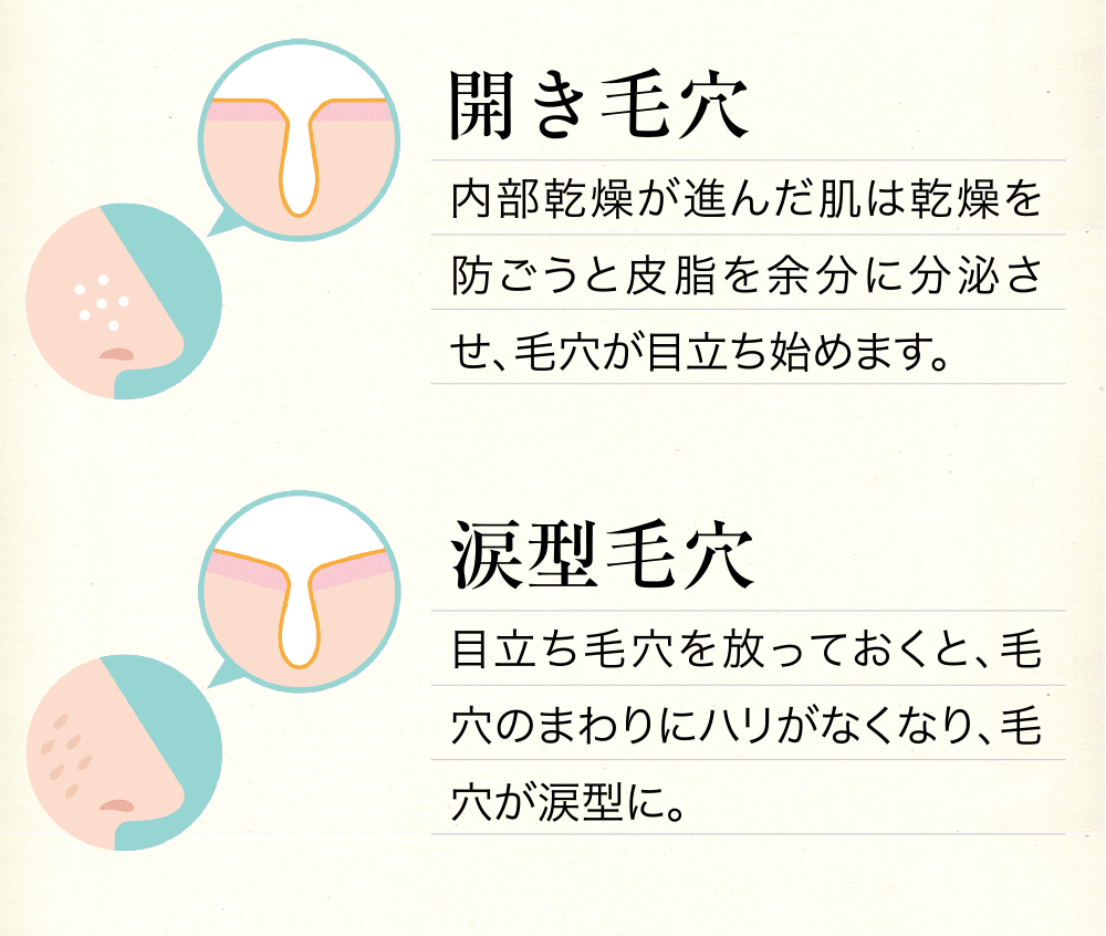 開き毛穴、涙型たるみ毛穴
