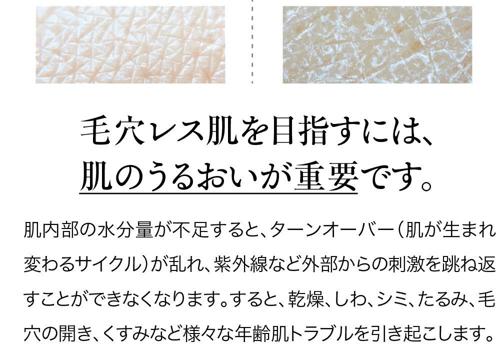 毛穴レス肌を目指すには肌のうるおいが重要です